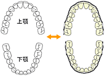 左右対称のアーチ型になるよう装置を装着