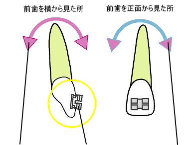 前歯を横からみた所　前歯を正面がらみた所