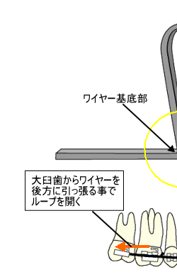 V-loopの拡大図