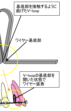 V-loopの拡大図