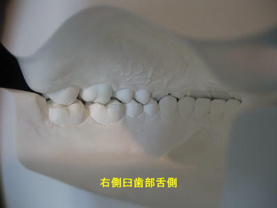 口腔内模型　右側臼歯部舌側