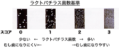 ラクトバチラス菌のコロニー数の検査