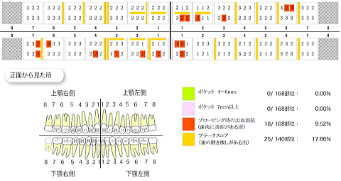 当院の歯周病予防検査の結果表による本症例の結果