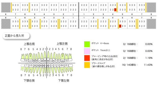 歯周基本検査結果