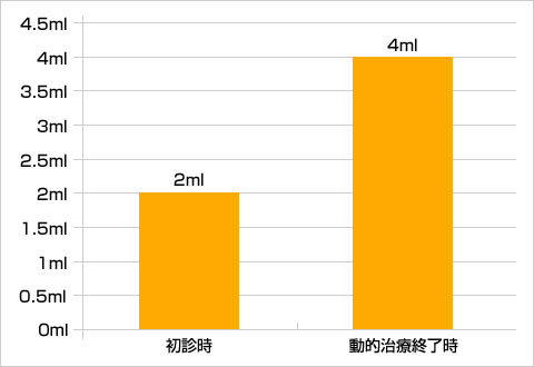 5分間刺激唾液分泌量の比較