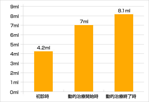 5分間刺激唾液分泌量の比較